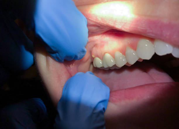 Best Weekend Emergency Dentist in Healdsburg, CA