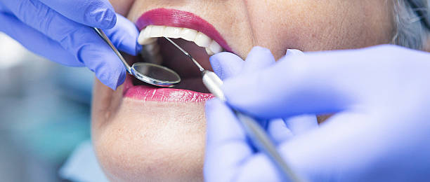 Best Holiday Emergency Dentist in Healdsburg, CA